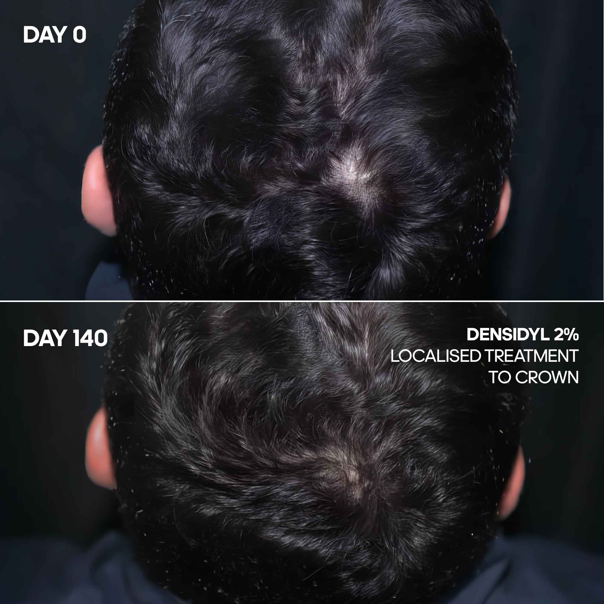 Advanced Hair Growth Serum